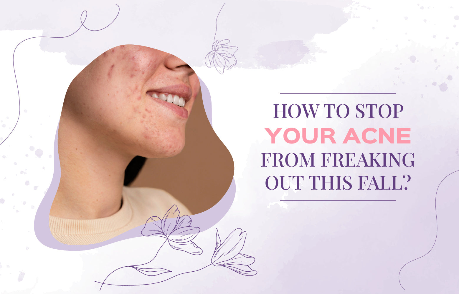 How to Stop Your Acne From Freaking Out This Fall - Arvelon