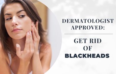 Dermatologist Approved: Get Rid of Blackheads