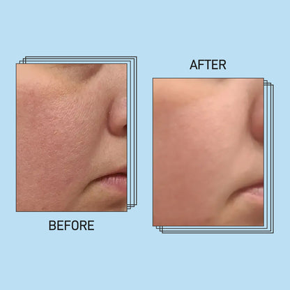 Barrier Repair Moisturizer