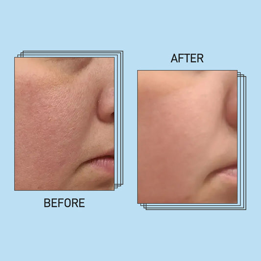 Barrier Repair Moisturizer