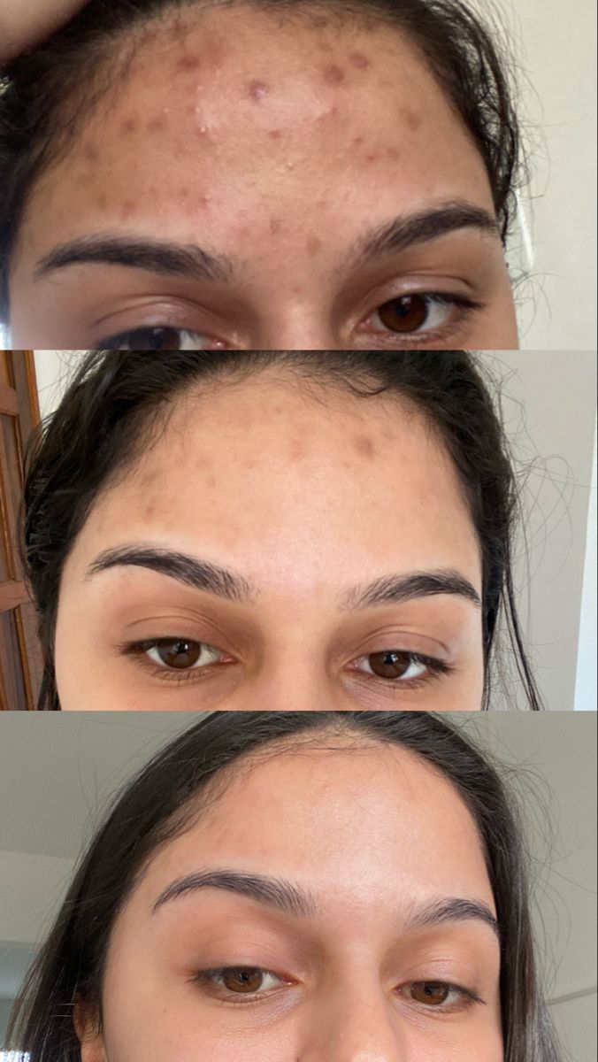 Flawless Glow Cream