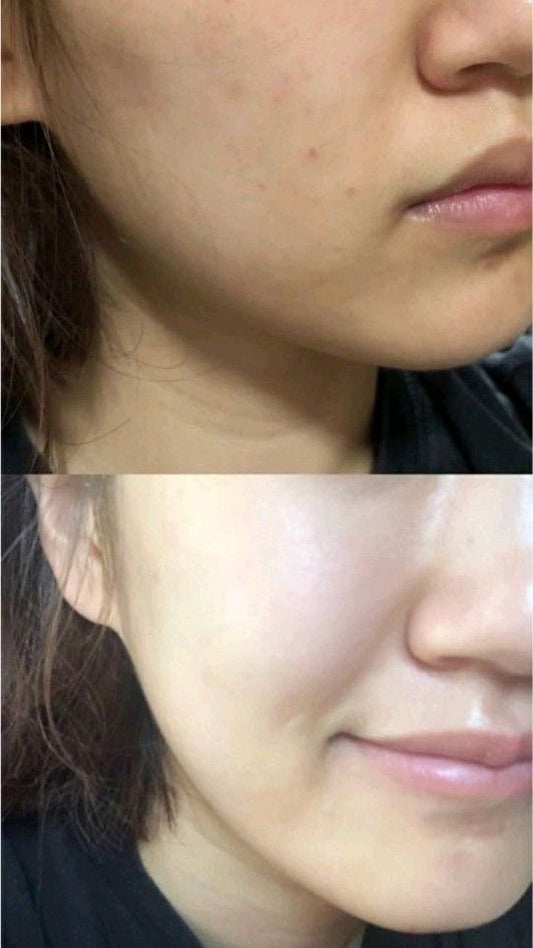 Advanced Glow Pack