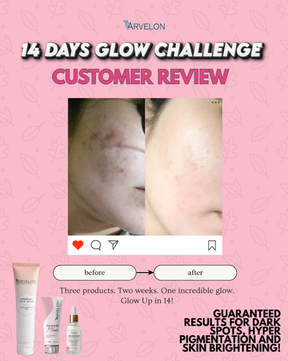 14 Days Challenge Kit