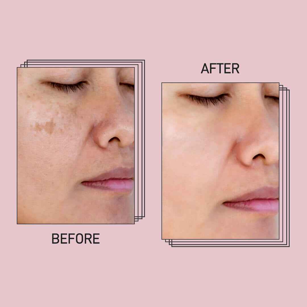 Woman using Arvelon glow cream for radiant skin